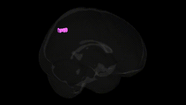 Full Brain Black