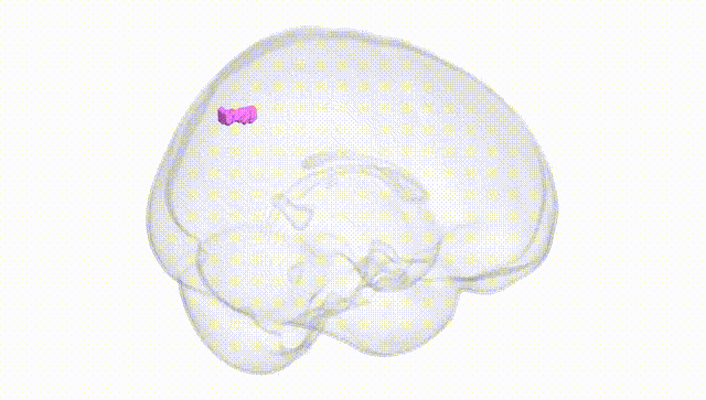Full Brain White