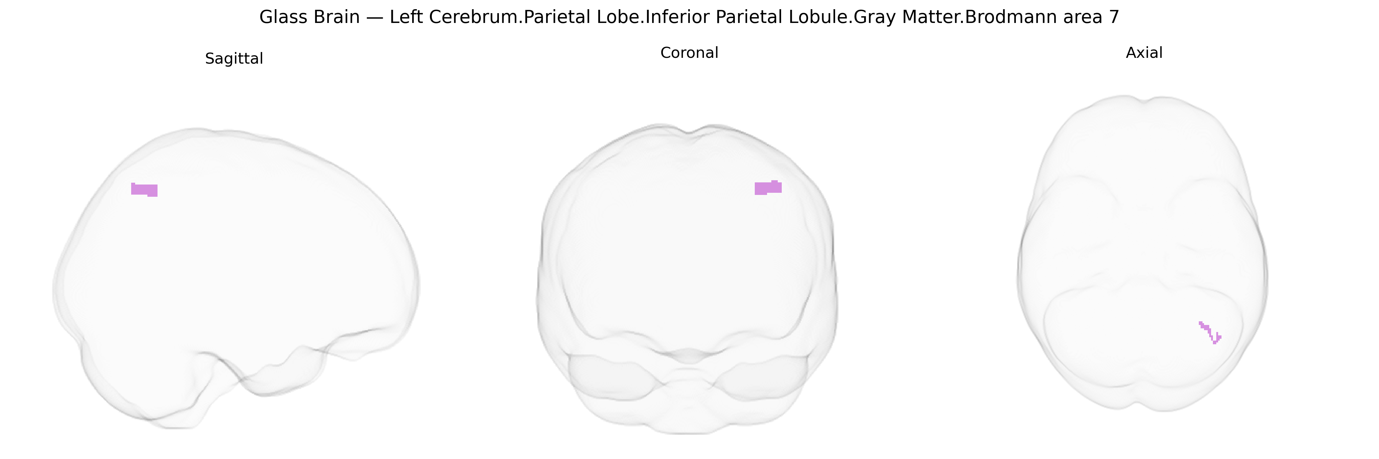 Triplanar Ghost Brain