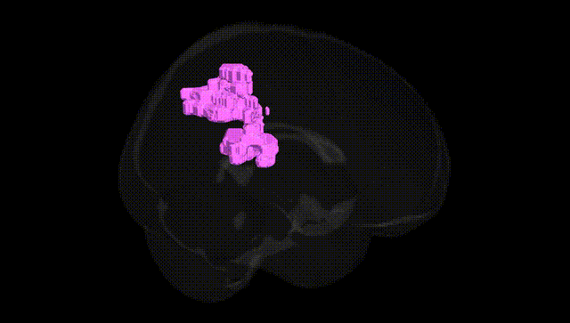 Full Brain Black