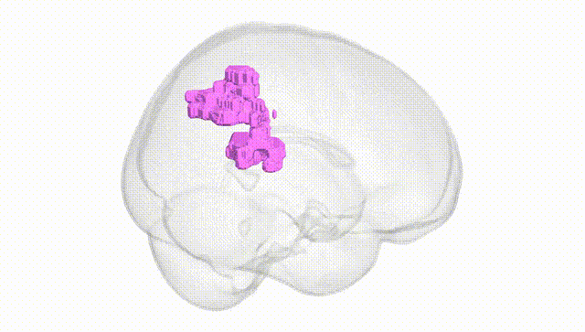 Full Brain White