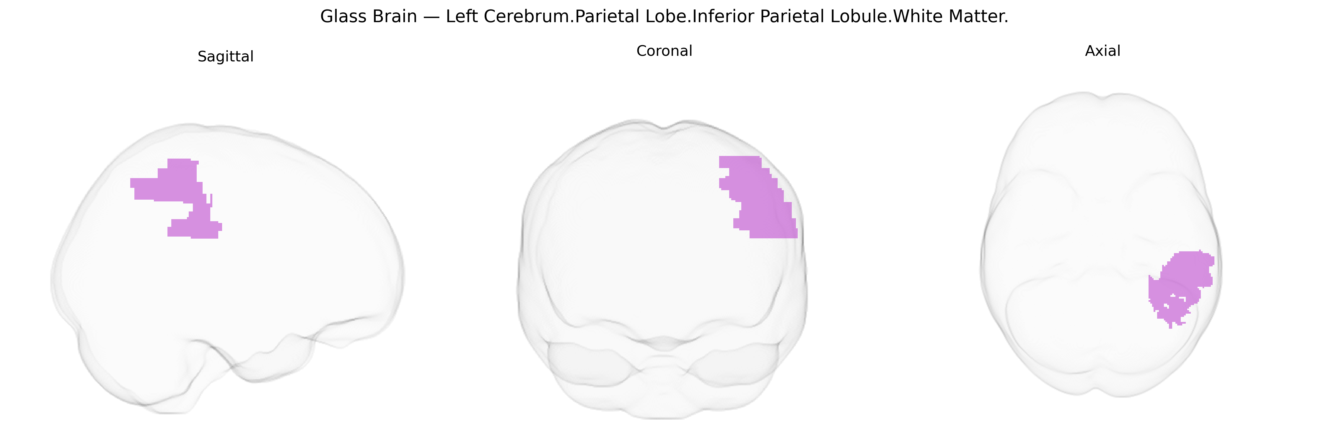 Triplanar Ghost Brain