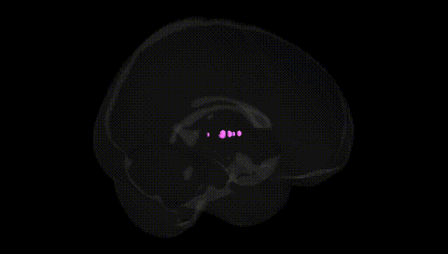 Full Brain Black