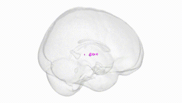 Full Brain White