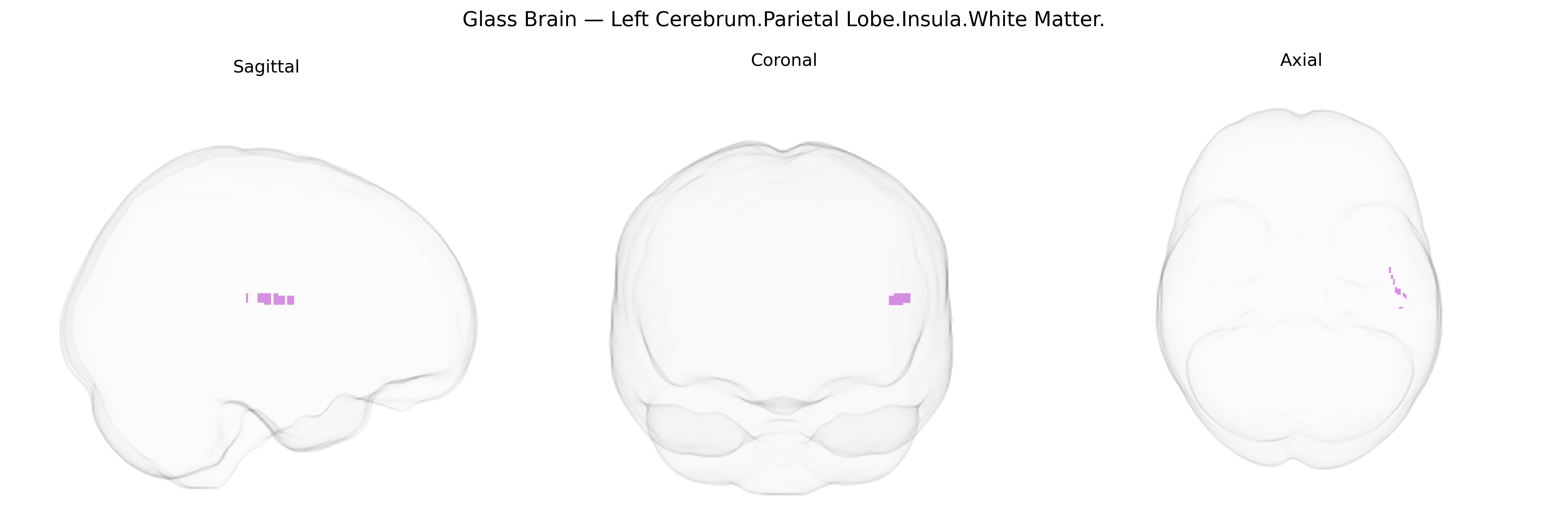 Triplanar Ghost Brain