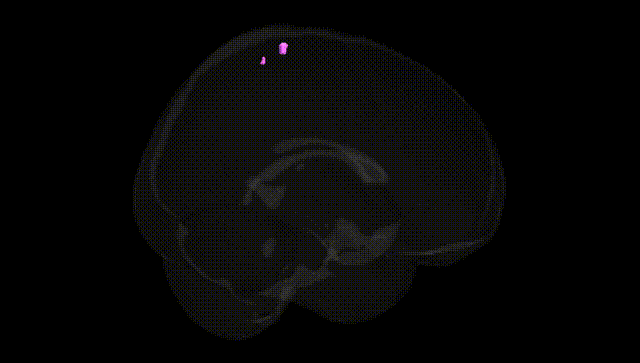 Full Brain Black