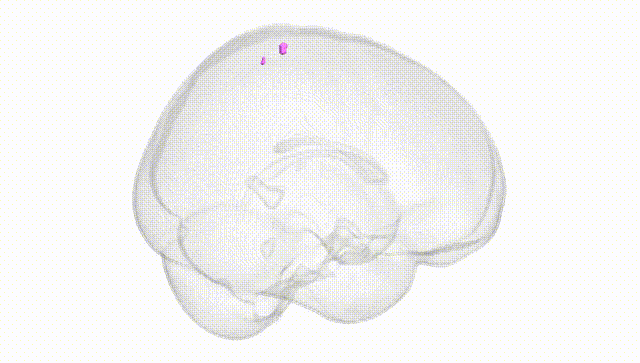 Full Brain White