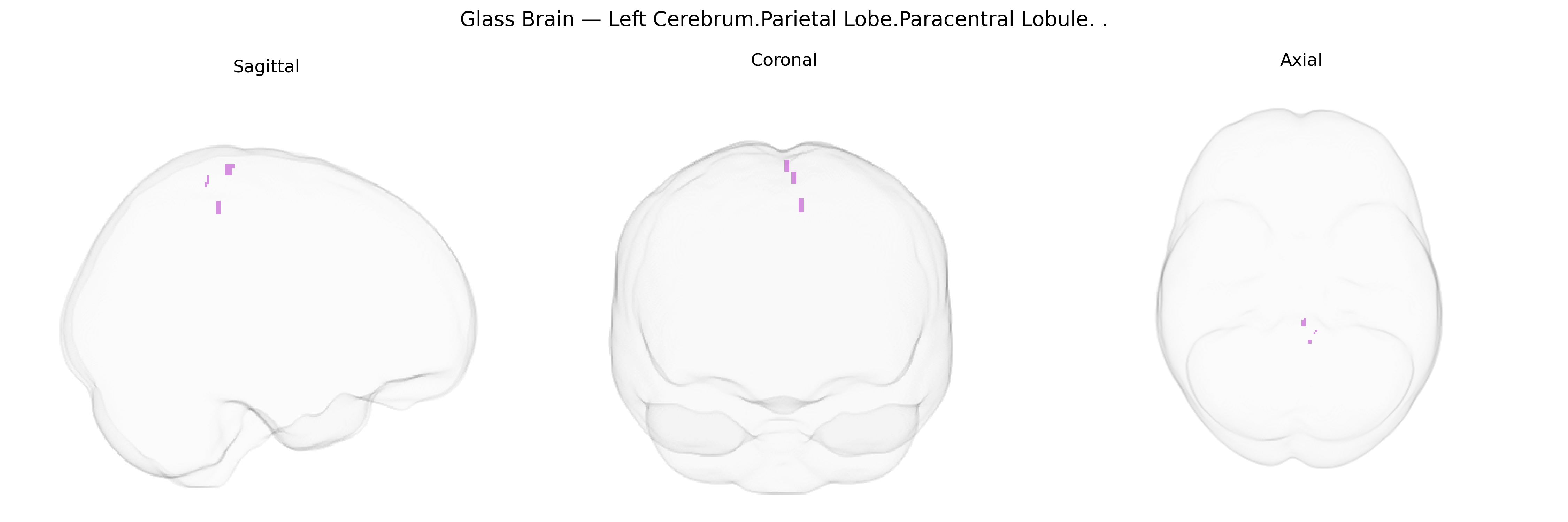 Triplanar Ghost Brain