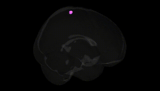 Full Brain Black