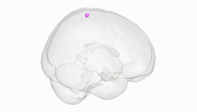 Full Brain White