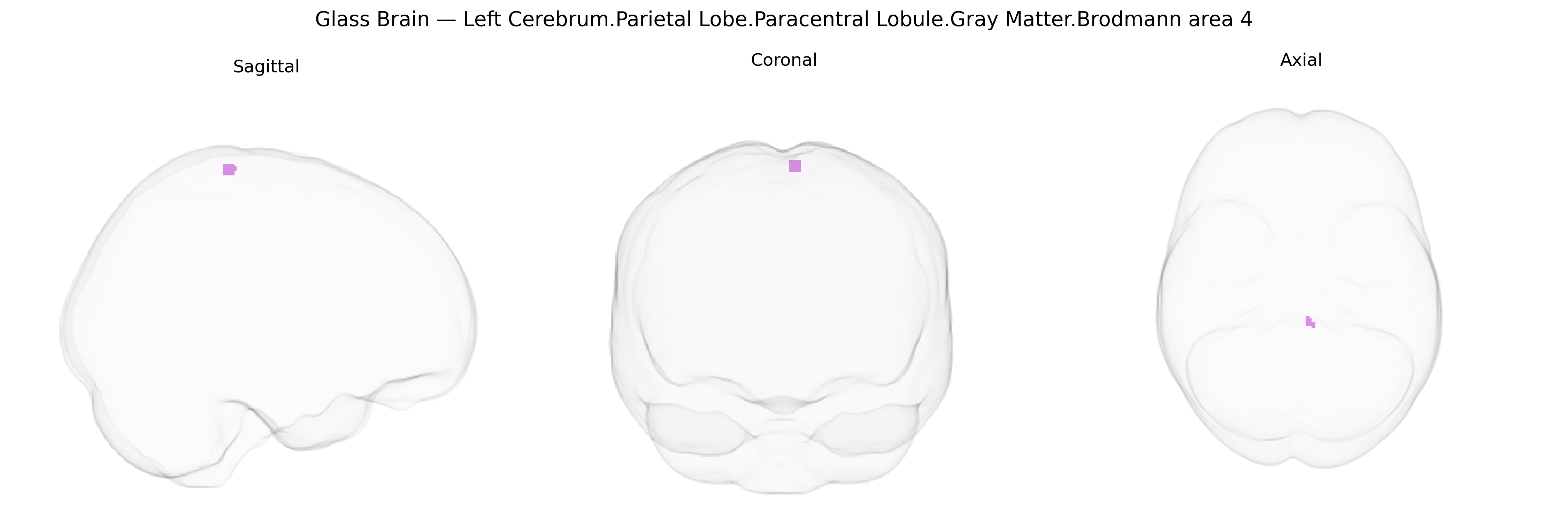 Triplanar Ghost Brain