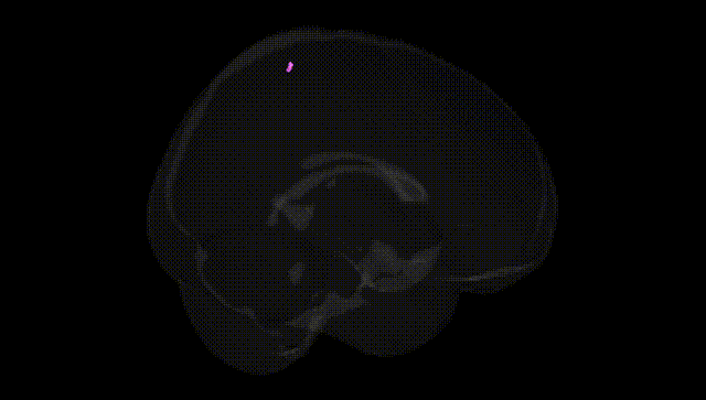 Full Brain Black