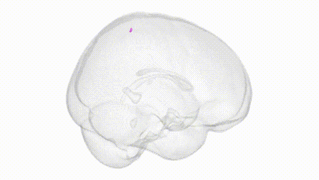 Full Brain White