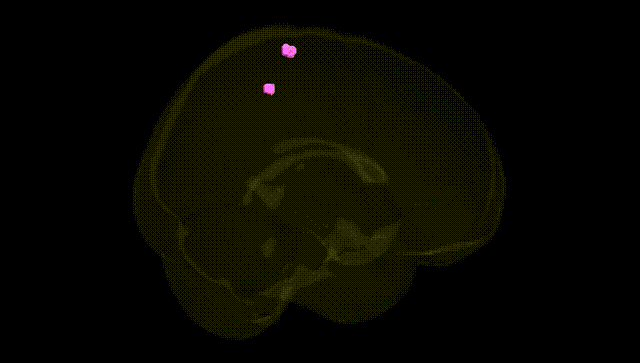 Full Brain Black