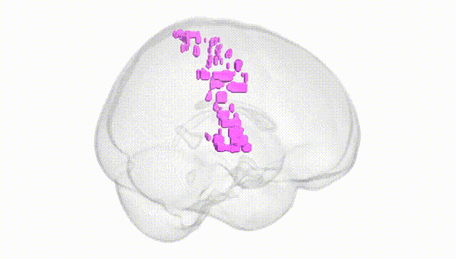 Full Brain White