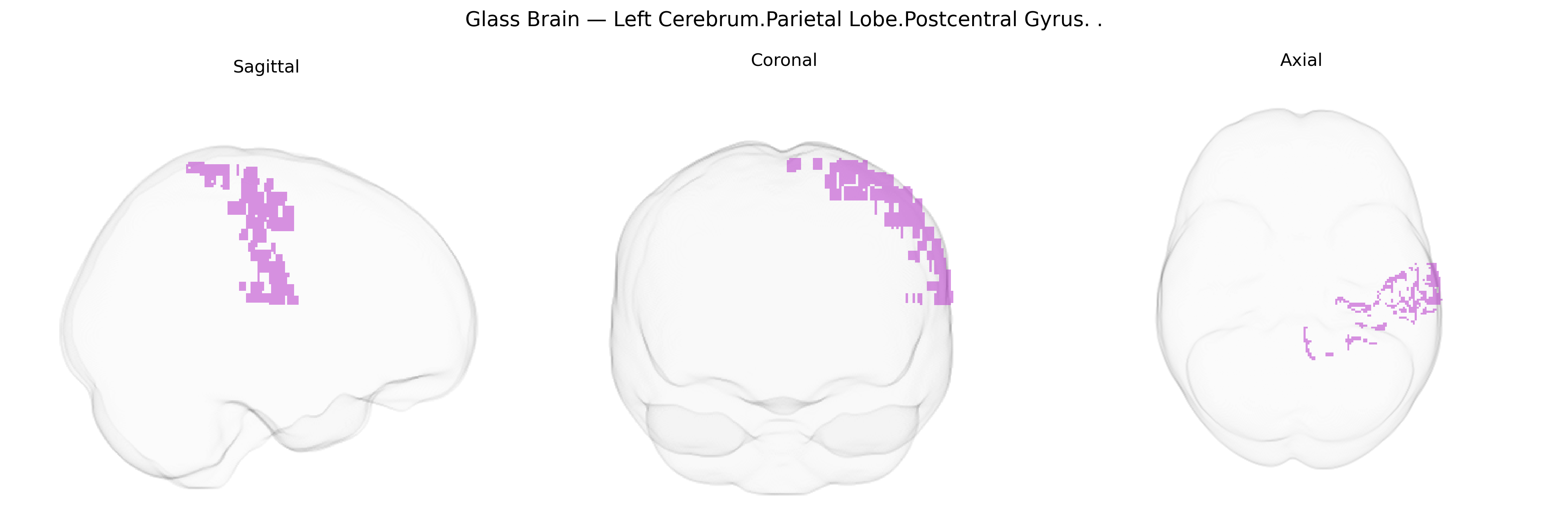 Triplanar Ghost Brain