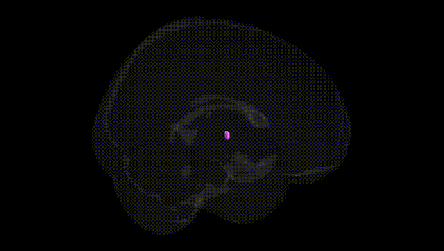 Full Brain Black