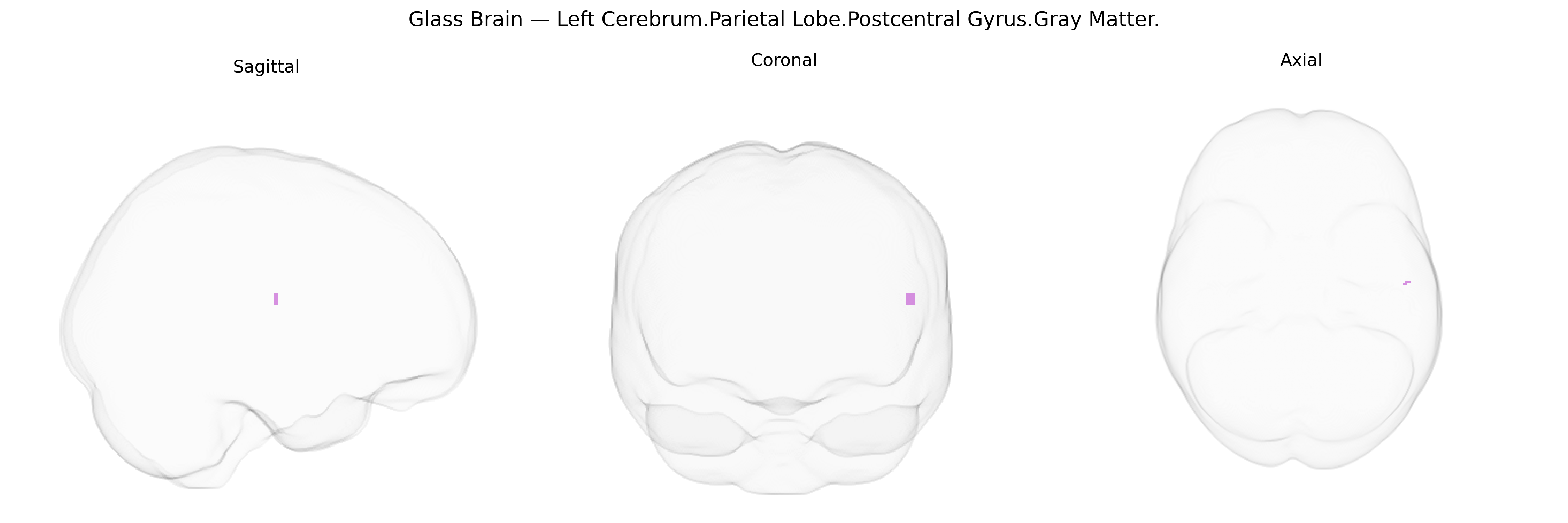 Triplanar Ghost Brain