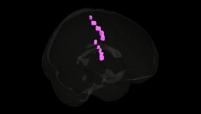 Full Brain Black