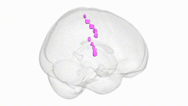 Full Brain White