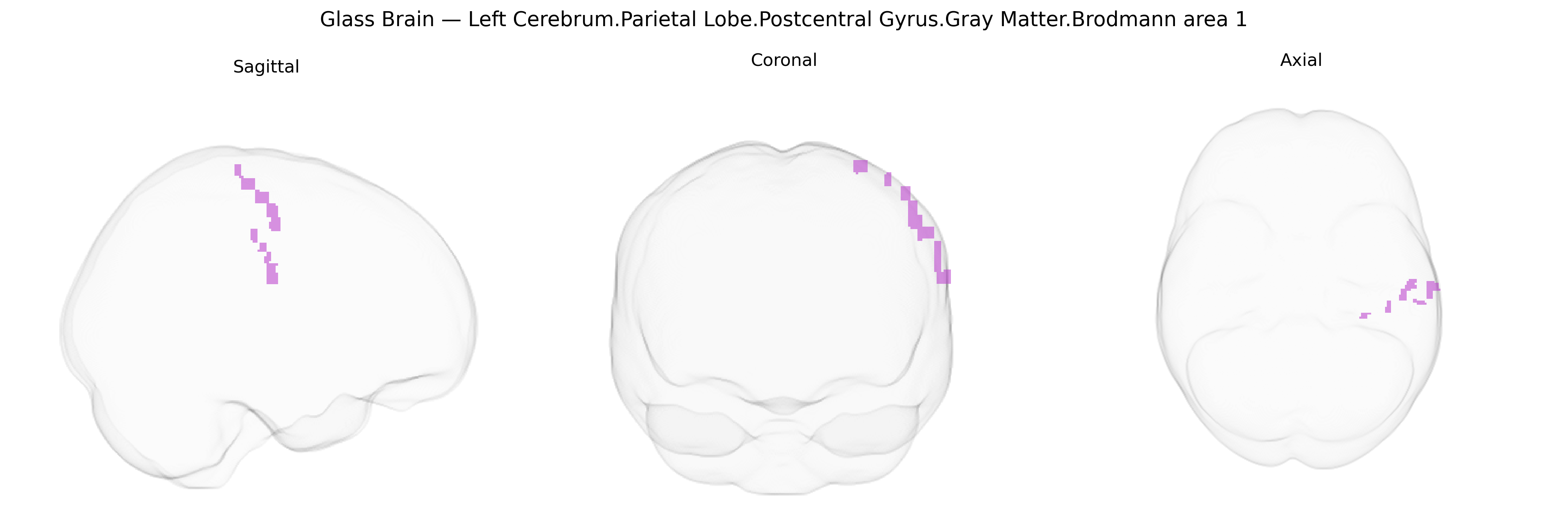 Triplanar Ghost Brain