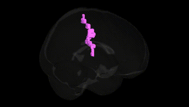 Full Brain Black
