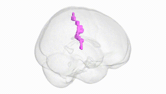 Full Brain White