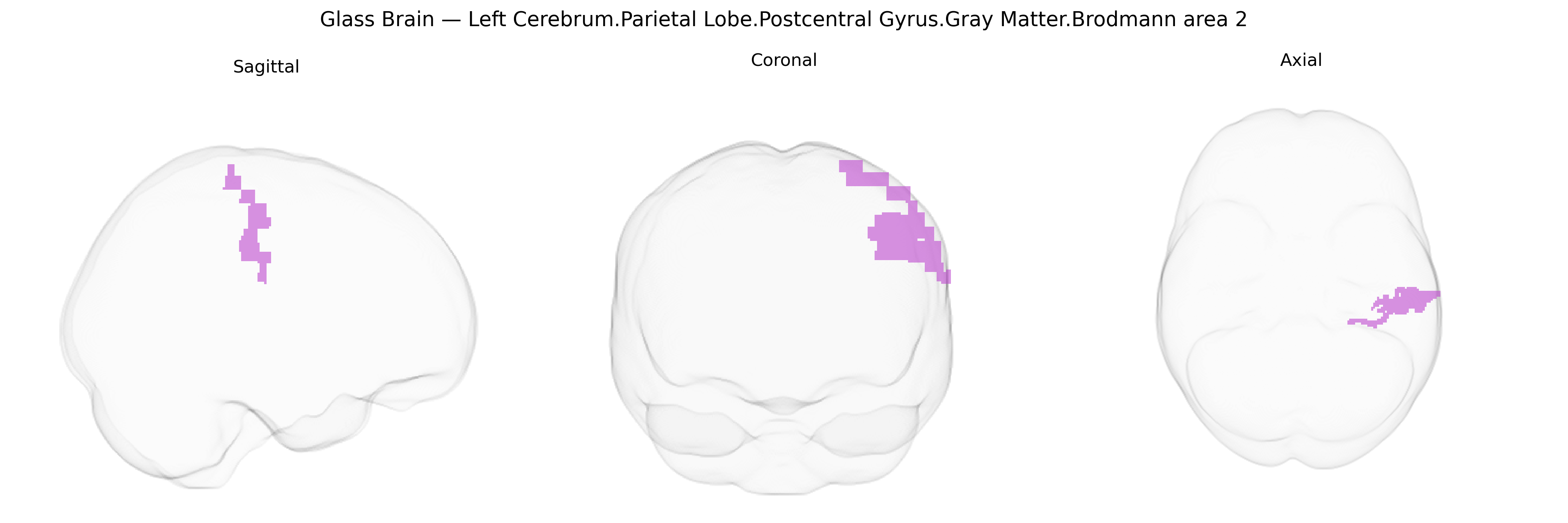 Triplanar Ghost Brain