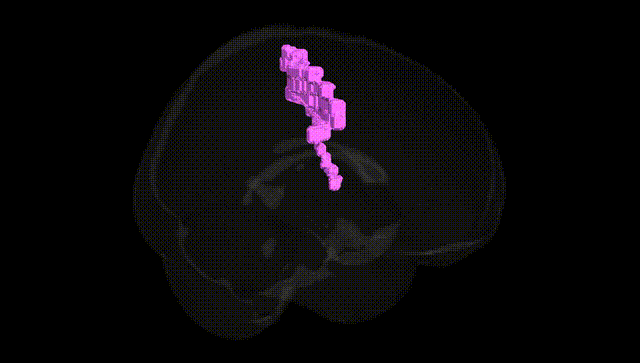 Full Brain Black