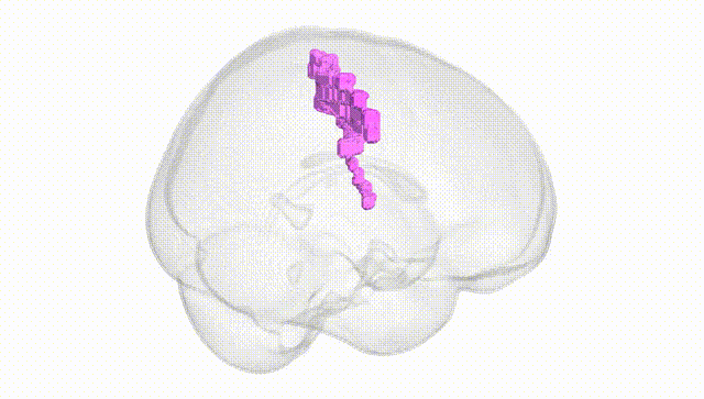Full Brain White