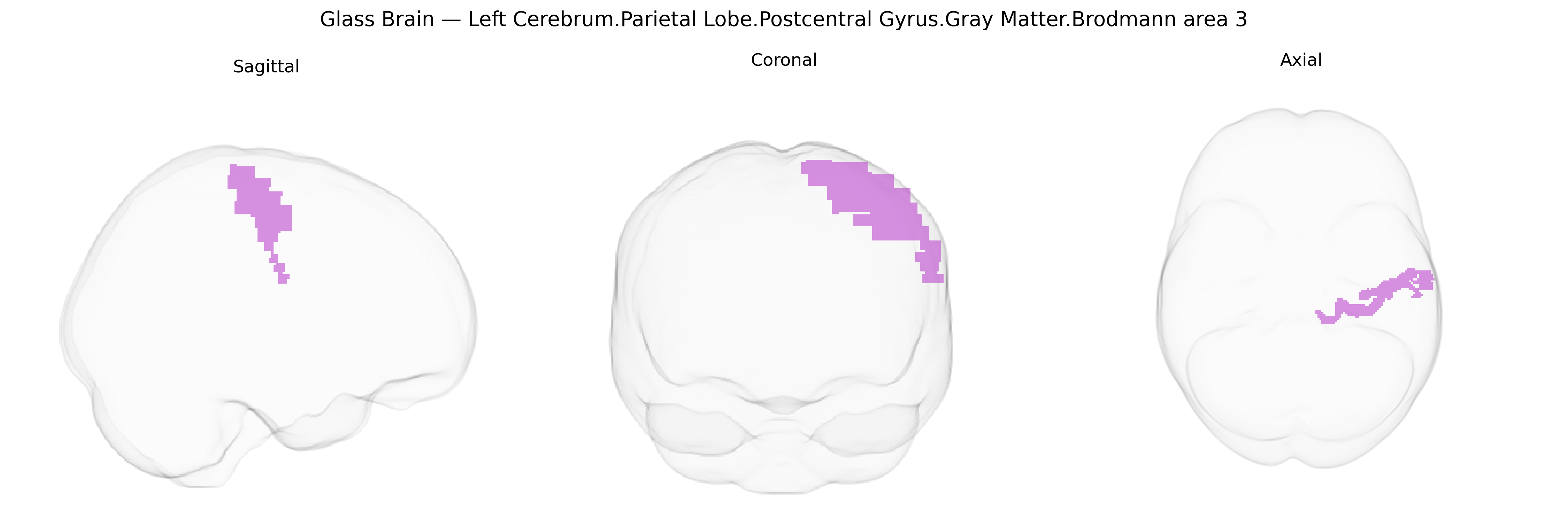 Triplanar Ghost Brain