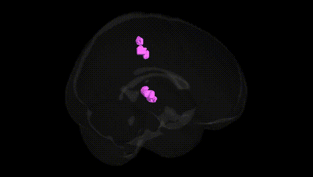 Full Brain Black