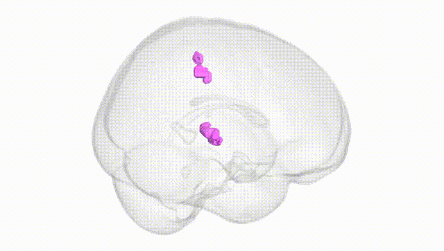 Full Brain White