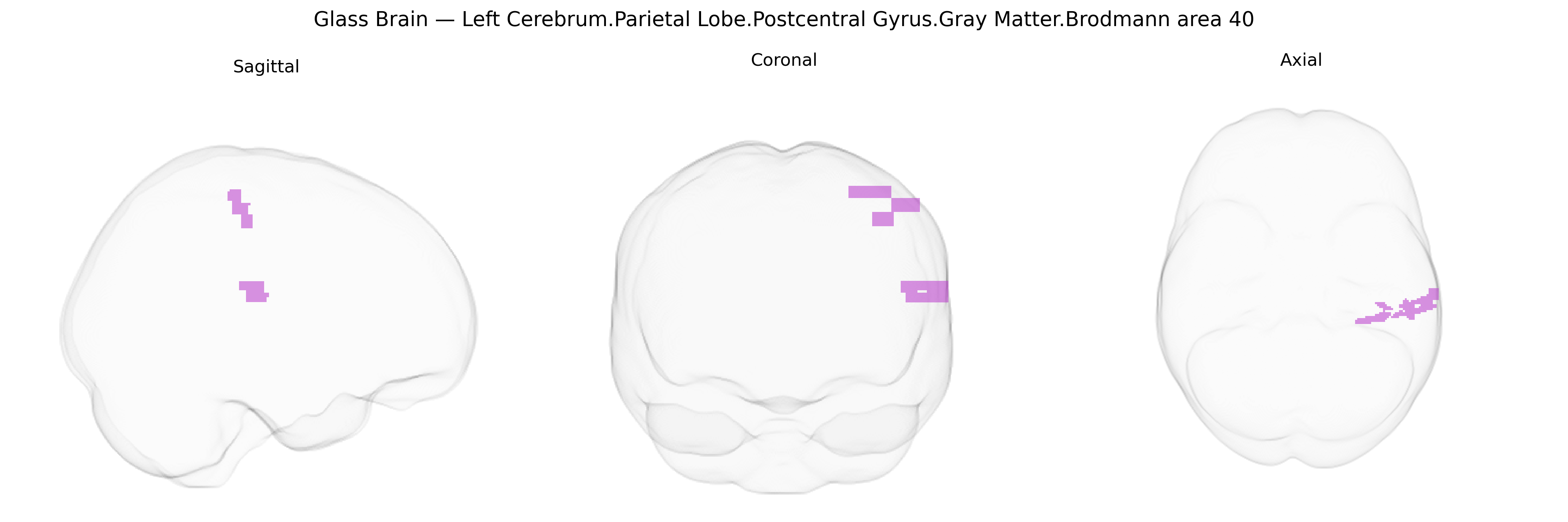 Triplanar Ghost Brain
