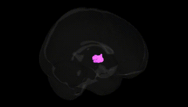 Full Brain Black