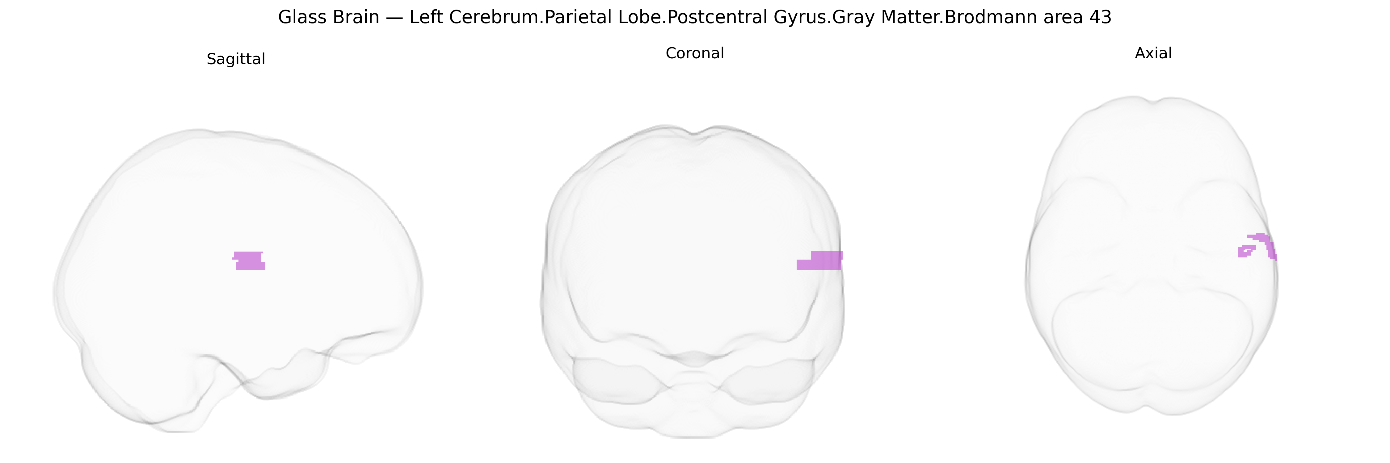 Triplanar Ghost Brain