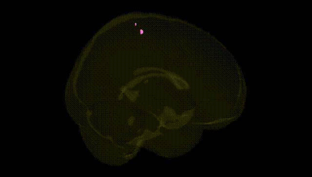 Full Brain Black