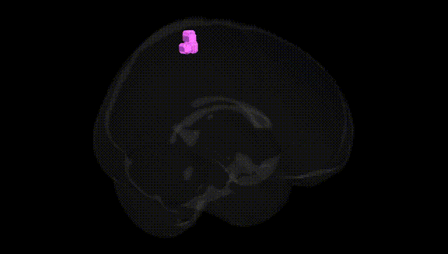 Full Brain Black