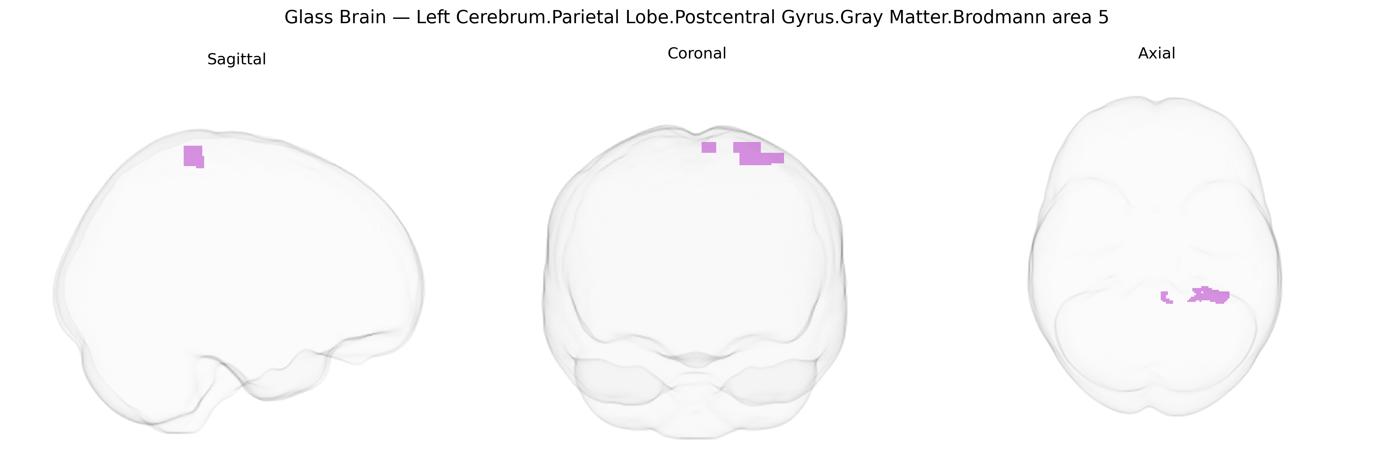 Triplanar Ghost Brain