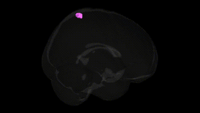 Full Brain Black