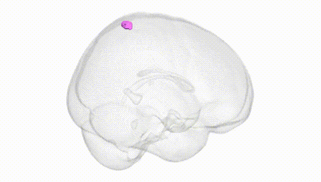 Full Brain White