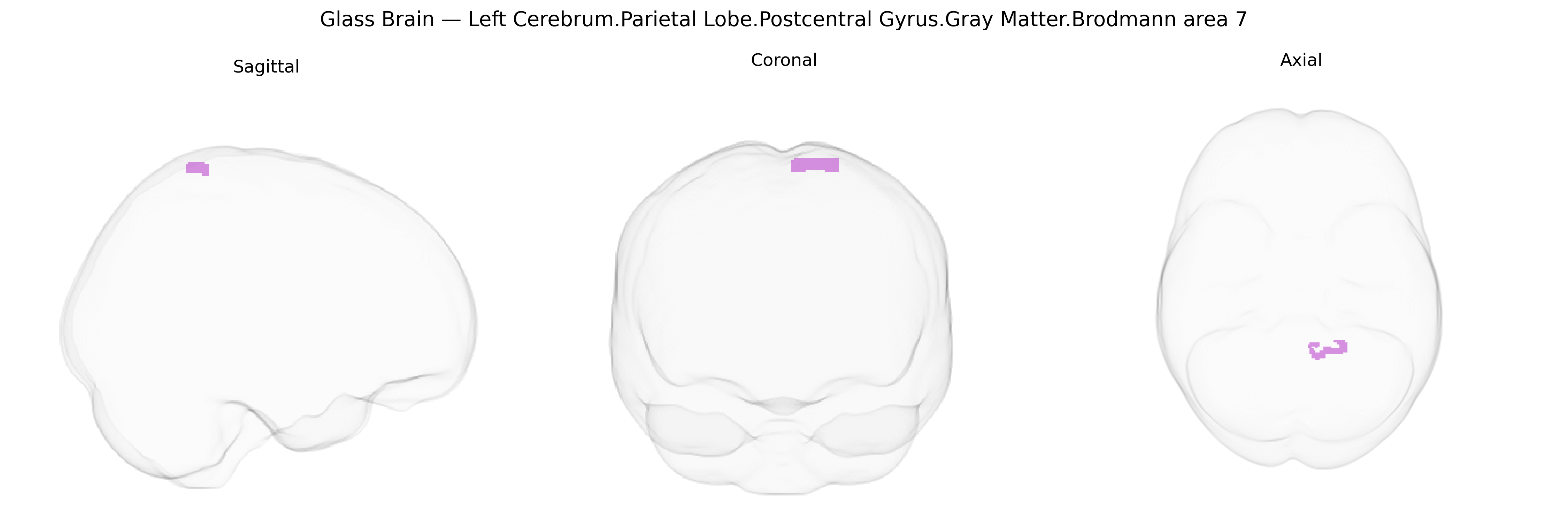 Triplanar Ghost Brain
