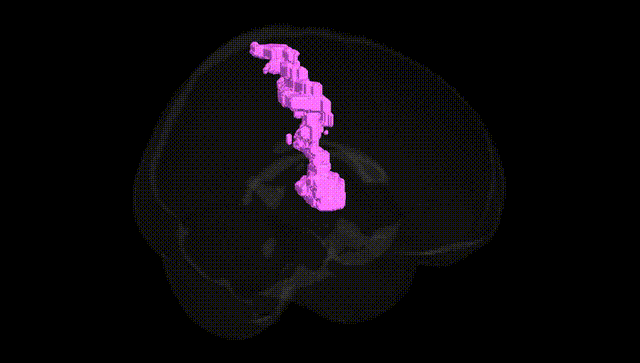 Full Brain Black