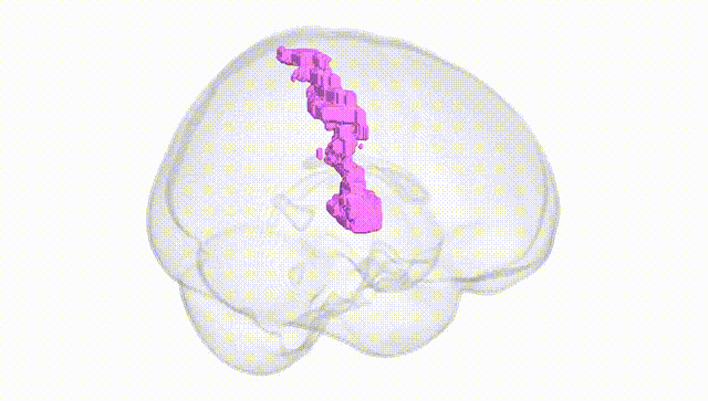 Full Brain White