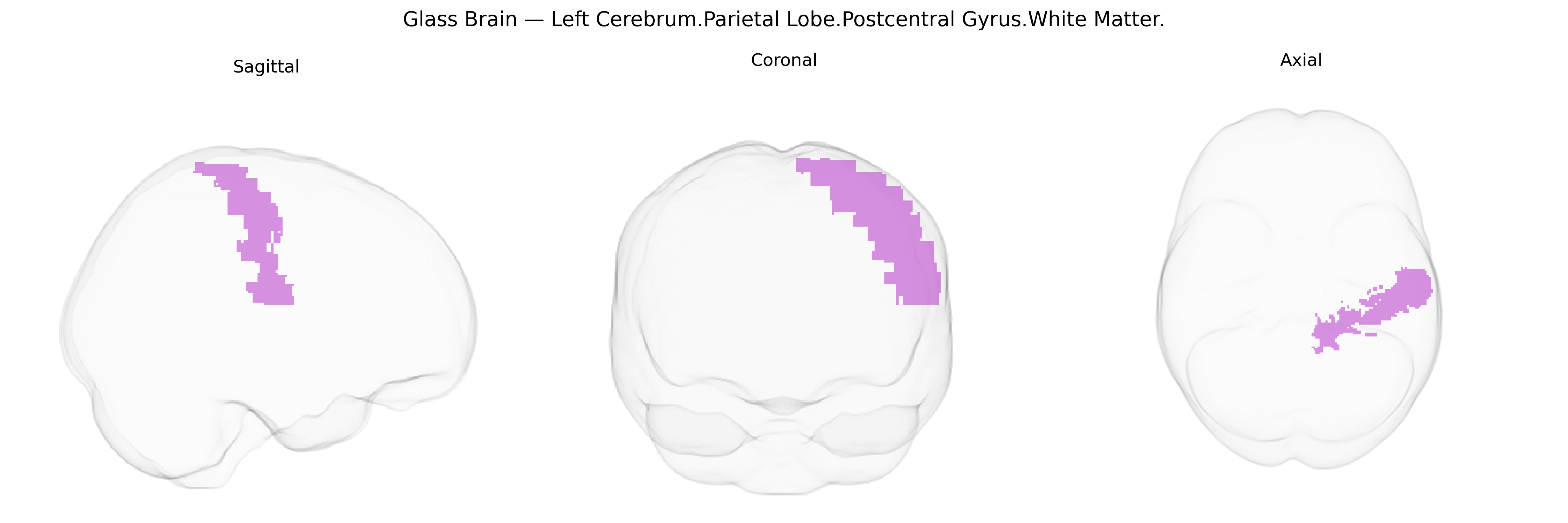 Triplanar Ghost Brain