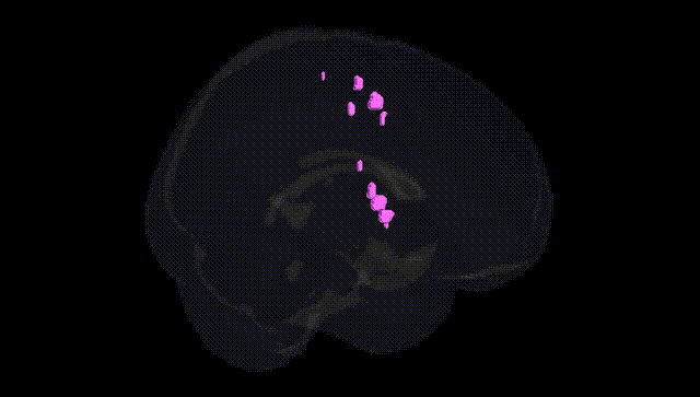 Full Brain Black