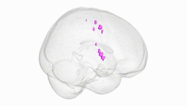Full Brain White