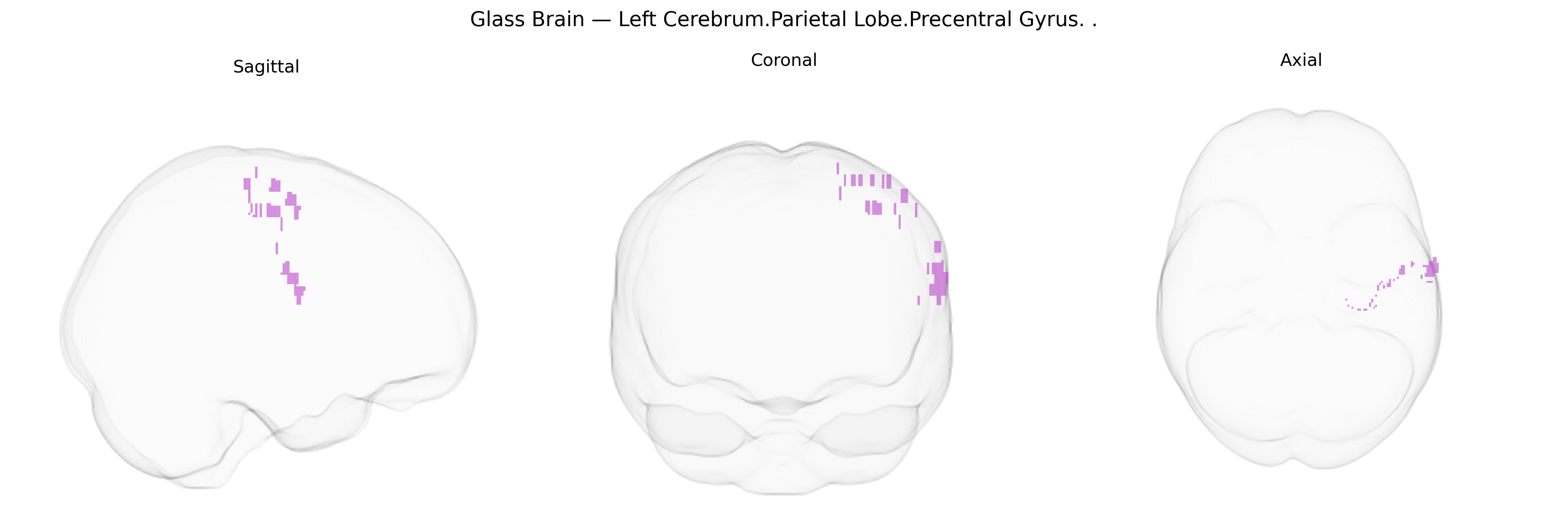 Triplanar Ghost Brain