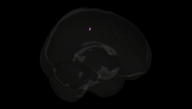 Full Brain Black
