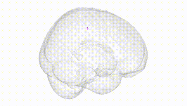Full Brain White